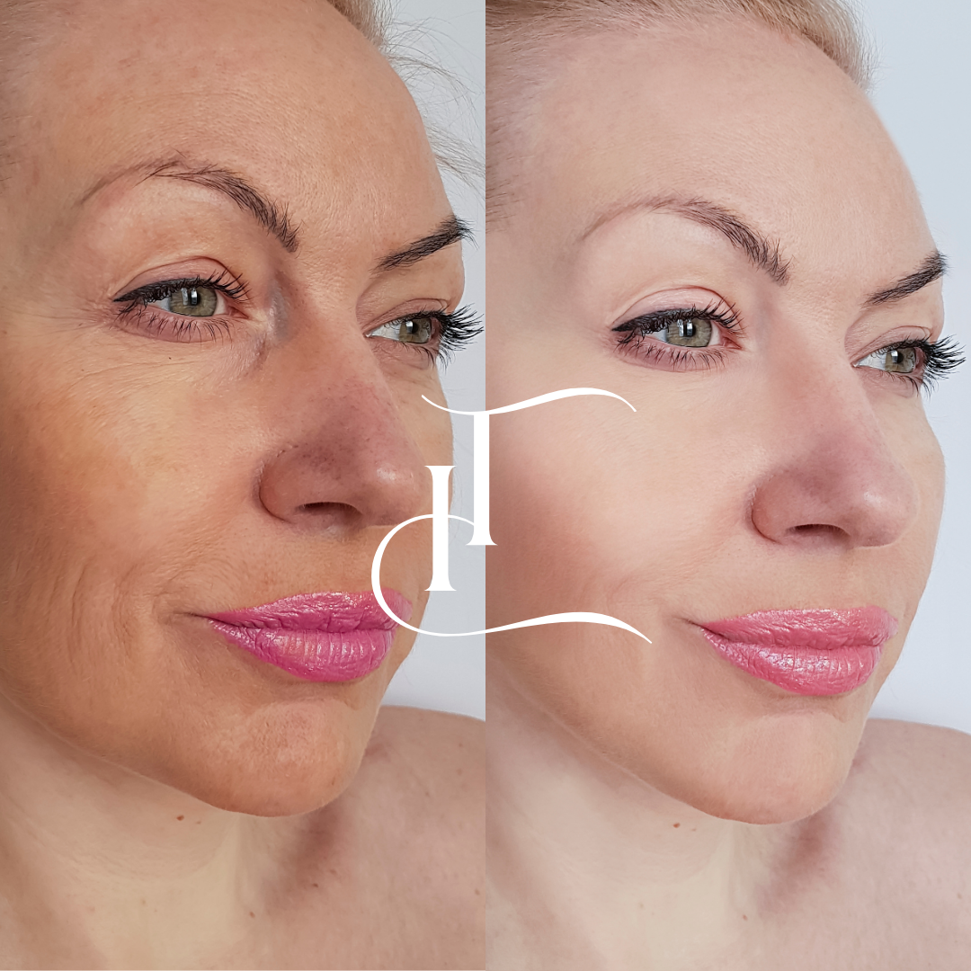 Especialista-em-Harmonizacao-Facial-6-1